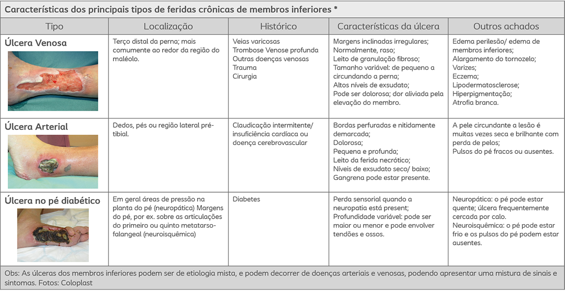  lcera De Perna
